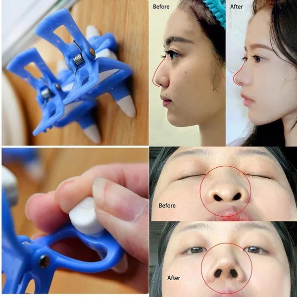 Pack of 5 Nose Shaper Clip Nose Slimmer Bridge For Nose Straightening Beauty